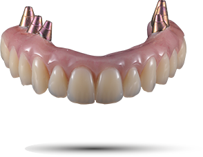 prothèse dent